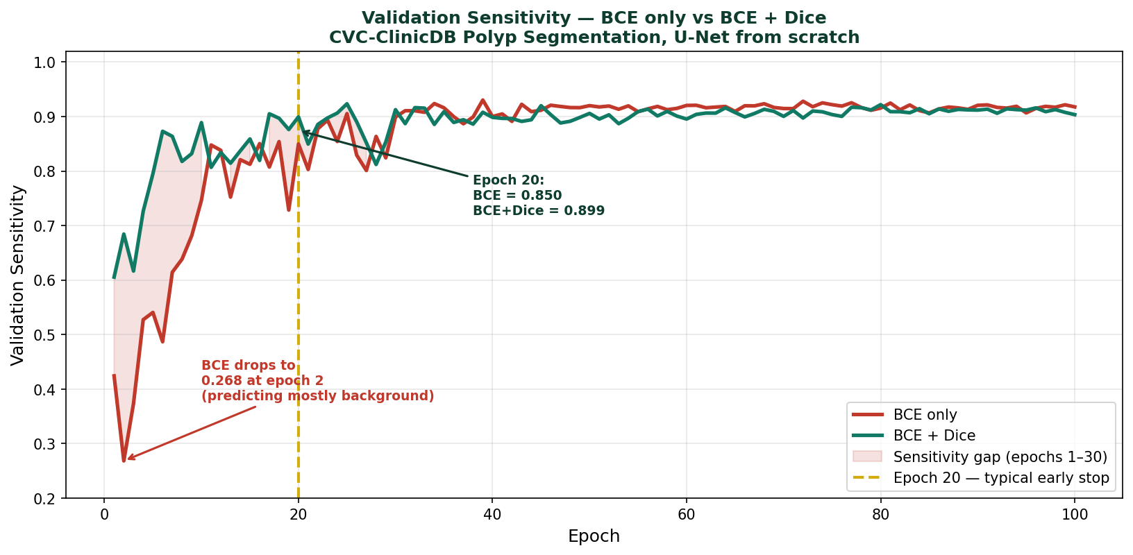 BCE vs BCE+Dice sensitivity training curve